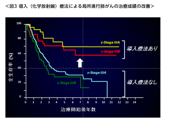 導入（化学放射線）療法による局所進行肺がんの治療成績の改善