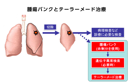 腫瘍バンクとテーラーメード治療