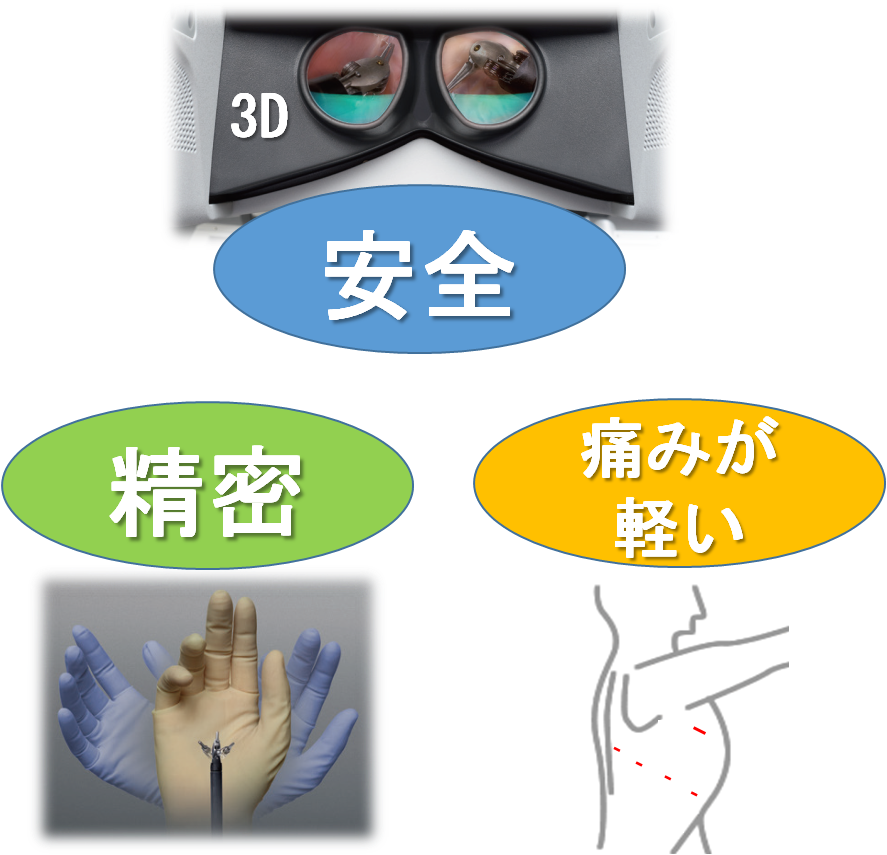 ロボット支援手術