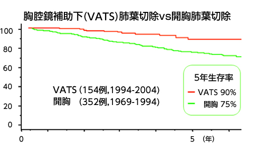 胸腔鏡補助下（VATS）肺葉切除vs開胸肺葉切除