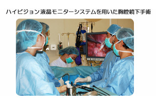 ハイビジョン液晶モニターシステムを用いた胸腔鏡下手術